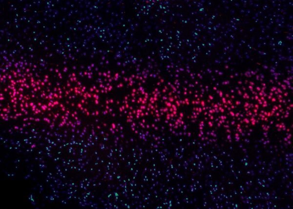 AI-Driven Predictive Analytics in Healthcare: Preventing Diseases Before They Strike