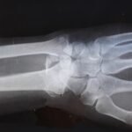 Photo Medical imaging