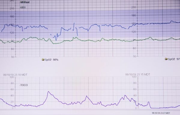 The Impact of AI on Personalized and Precision Medicine