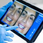 Photo AI, orthodontic treatment, prediction, monitoring