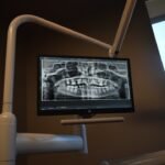 Photo Intraoral scanners