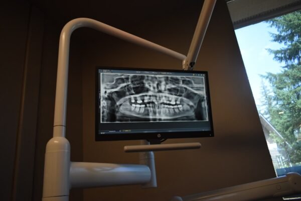 Intraoral scanners exceeding 60% penetration in the USA and Northern Europe as the new standard of care